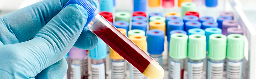 Hematological